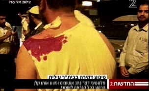 פיגוע דקירה בביתר עילית: ישראלי נפצע קל